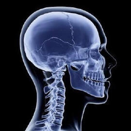 X-Ray System